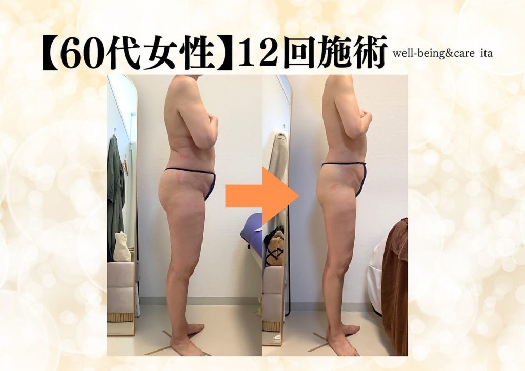 【ダイエット成功の秘訣】本当に大切なのは「知識」と「メンタル」だった！