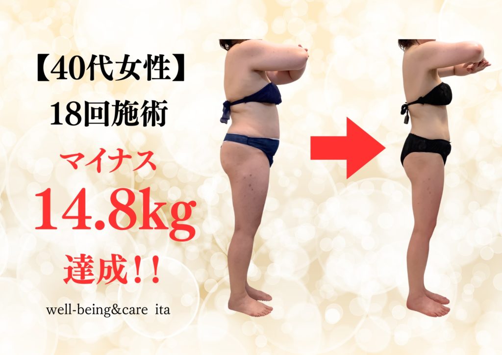 【Before/After】成功事例紹介♡